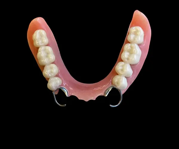 prótesis dentales parciales en laboratorio dental del valle Sangolquí